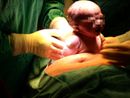 Papà accanto alla mamma anche durante i cesarei: nascita più &quot;dolce&quot; e inclusiva al Policlinico di Milano