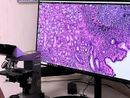 Progetto Pnrr anatomia patologica digitale: ASST Pavia installa i nuovi scanner per vetrini istologici negli ospedali di Vigevano e Voghera Progetto Pnrr anatomia patologica digitale: ASST Pavia installa i nuovi scanner per vetrini istologici negli ospedali di Vigevano e Voghera