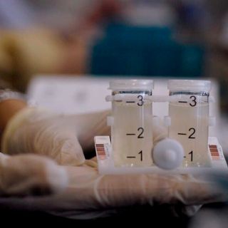 Cesano Boscone, casi di legionella in una scuola