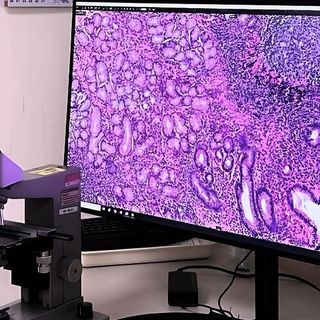 Progetto Pnrr anatomia patologica digitale: ASST Pavia installa i nuovi scanner per vetrini istologici negli ospedali di Vigevano e Voghera