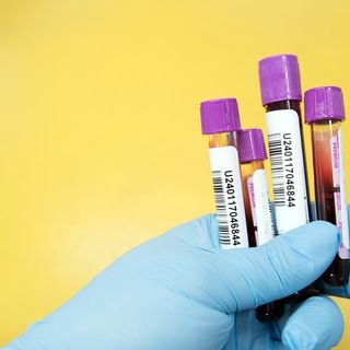 Covid-19, in Italia oggi 10.800 casi e 348 vittime. Veneto la regione più colpita con 1.682 positivi, in Lombardia sono 863