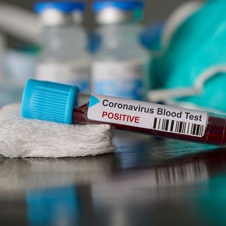 Covid-19, in Italia oggi 17.083 nuovi contagi e 343 vittime. Nuova impennata in Lombardia