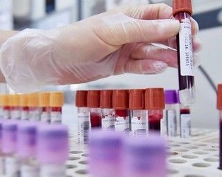 Covid, indice Rt nazionale a 1,09, nove regioni sopra la soglia 1