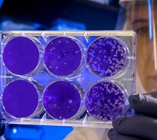 Covid-19, in Italia oggi 17.567 nuovi contagi e 344 vittime. Nel Pavese calo rispetto a ieri