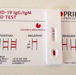 Coronavirus, in provincia di Pavia 1.722 nuovi contagi. In Lombardia 33.249 casi e in Italia 180.426