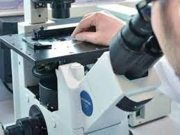 Microcalcificazioni del seno: non tutte sono correlate all’insorgenza del tumore