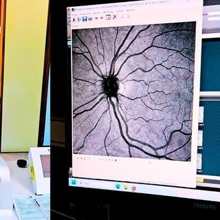 Vigevano, fluorangiografo di ultima generazione operativo presso l'oculistica del civile