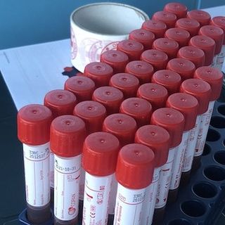 Coronavirus, i comuni con più di 40 contagi in provincia di Pavia al 21 giugno