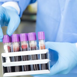 Covid-19, in Italia oggi 18.727 contagi. Veneto +3.833, Lombardia + 2.938, Piemonte +1.533, Campania +1.340