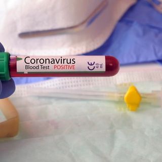 Il Coronavirus rallenta ancora, in provincia di Pavia 67 nuovi contagi