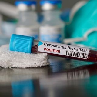Coronavirus, in Lombardia 259 nuovi contagi