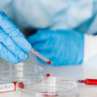 Coronavirus, comune per comune i dati dei contagi in provincia di Pavia al 25 aprile