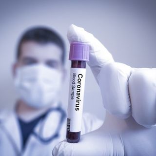 La fase &quot;sconosciuta&quot; del Coronavirus: «In Lombardia almeno 1.200 contagiati già prima del paziente 1»