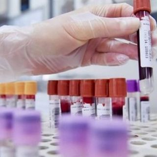 Coronavirus, comune per comune i dati dei contagi in provincia di Pavia al 10 aprile