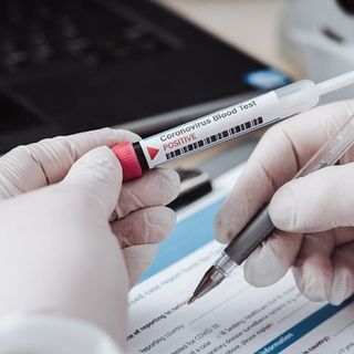 Coronavirus, lo studio dei virologi: «I debolmente positivi non sono contagiosi»