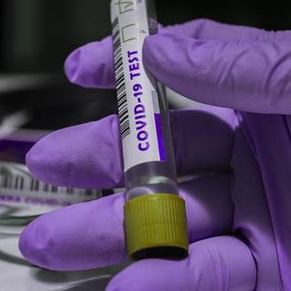 Covid-19, in Italia oggi contagi dimezzati, ma anche tamponi: 10.407 nuovi positivi e 261 vittime