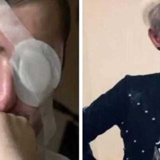 Legnano, aggredì l’ex con acido: Sara del Mastro condannata a 7 anni e 10 mesi