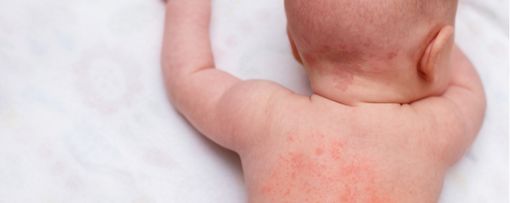 Milano, bimba ferita dallo spray della madre: violenza preoccupante