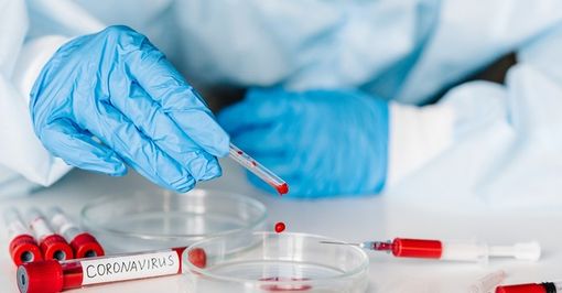 Coronavirus, i comuni con più di 35 contagi in provincia di Pavia al 27 maggio