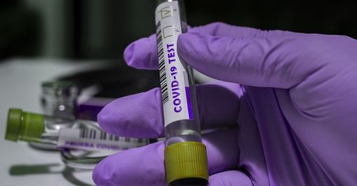 Coronavirus, i comuni con più di 40 contagi in provincia di Pavia al 30 maggio