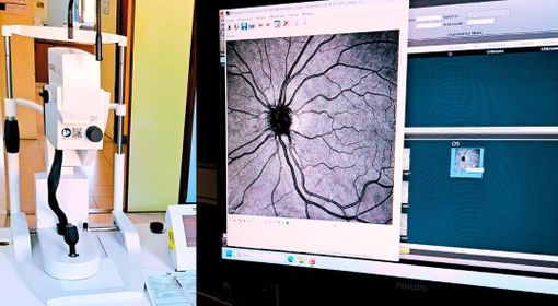 Vigevano, fluorangiografo di ultima generazione operativo presso l'oculistica del civile