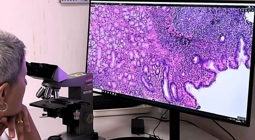 Progetto Pnrr anatomia patologica digitale: ASST Pavia installa i nuovi scanner per vetrini istologici negli ospedali di Vigevano e Voghera