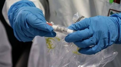 Covid-19, i comuni più colpiti in provincia di Pavia al 27 novembre Covid-19, i comuni più colpiti in provincia di Pavia al 27 novembre