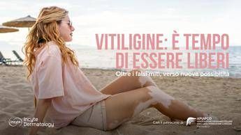 Salute, Giornata vitiligine: al via campagna 'Oltre falsi miti verso nuove possibilità'