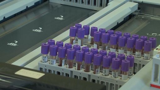 Covid, bloccata in Italia la terapia con l'idrossiclorochina Covid, bloccata in Italia la terapia con l'idrossiclorochina