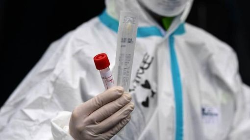 Covid-19, i comuni più colpiti in provincia di Pavia all'11 gennaio Covid-19, i comuni più colpiti in provincia di Pavia all'11 gennaio