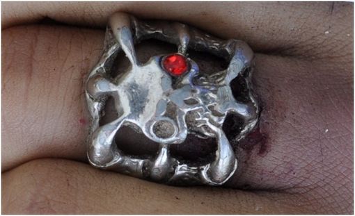FOTO. Dai tatuaggi e da un anello si cerca di dare un nome al cadavere rinvenuto sabato sulla superstrada di Malpensa