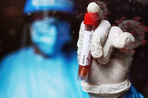 Covid-19, in Italia oggi 19.350 contagi. Lombardia +4.048, Veneto +2.535, Piemonte +1.617, Campania +1.113 Covid-19, in Italia oggi 19.350 contagi. Lombardia +4.048, Veneto +2.535, Piemonte +1.617, Campania +1.113