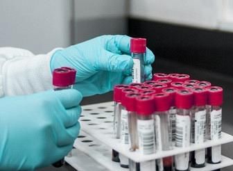 Vaccino anti-Covid? Non convince 1 italiano su 2 Vaccino anti-Covid? Non convince 1 italiano su 2