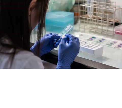 Allarme legionella a Milano, diversi palazzi in zona Loreto a rischio infezione