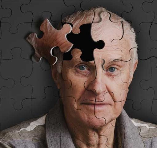 Alzheimer: ogni 3 secondi un caso nel mondo