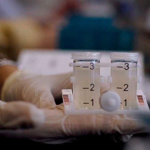 Corsico-Buccinasco, dieci casi di legionella. Chiuse le fontane pubbliche