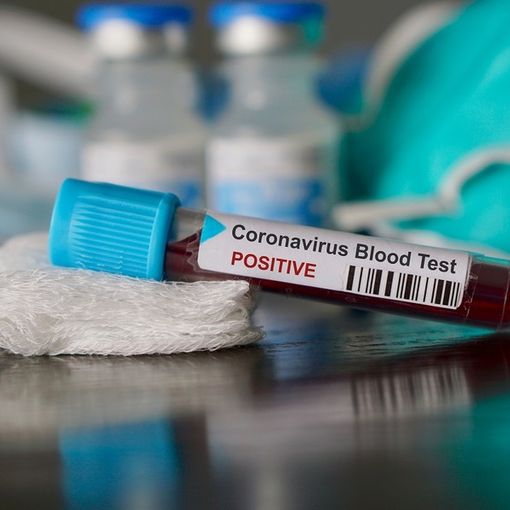 Covid-19, in Italia oggi 17.083 nuovi contagi e 343 vittime. Nuova impennata in Lombardia