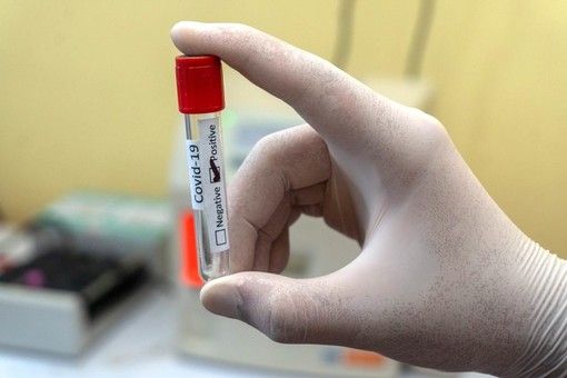 Covid, in provincia di Pavia 2 contagi. In Lombardia sono 119 con 2 vittime