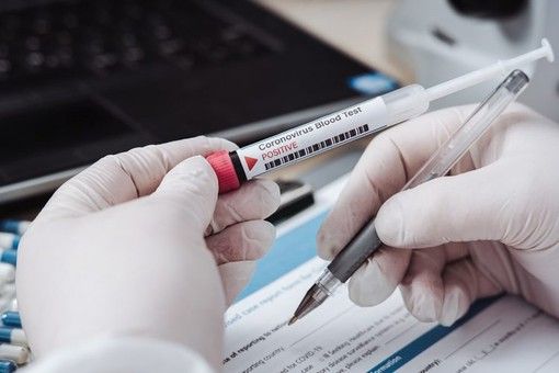 Covid-19, in Italia oggi 23.832 nuovi contagi e 401 vittime. Lombardia +4.810, Emilia +2.560, Campania +2.196
