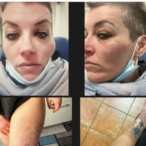 Le foto postate dalla cantante sulla sua pagina Facebook