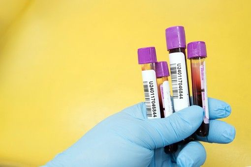 Coronavirus, in provincia di Pavia 179 contagi. In Lombardia 3.099 casi e 11 vittime