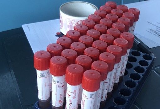 Coronavirus, i comuni con più di 40 contagi in provincia di Pavia al 21 giugno