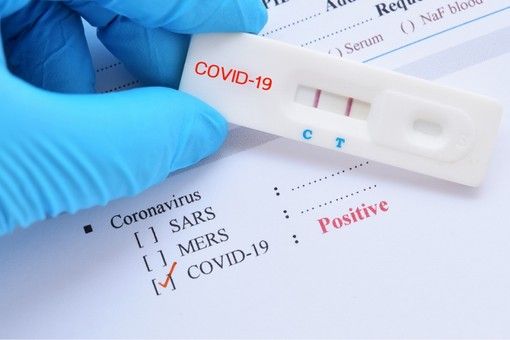 Covid-19, in Italia oggi 13.331 contagi e 488 vittime. In Lombardia 1.535 nuovi positivi