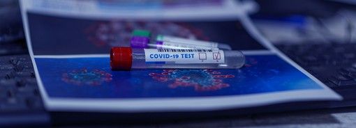 Coronavirus, i comuni con più di 35 contagi in provincia di Pavia al 28 maggio