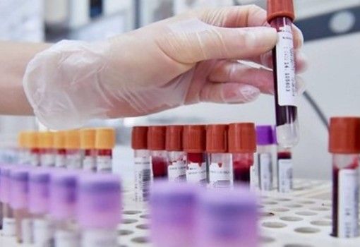 Coronavirus: comune per comune i dati dei casi confermati in provincia di Pavia al 6 aprile
