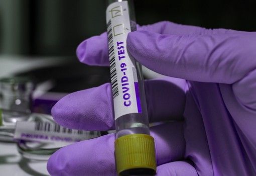 Coronavirus, i comuni con più di 40 contagi in provincia di Pavia al 2 giugno