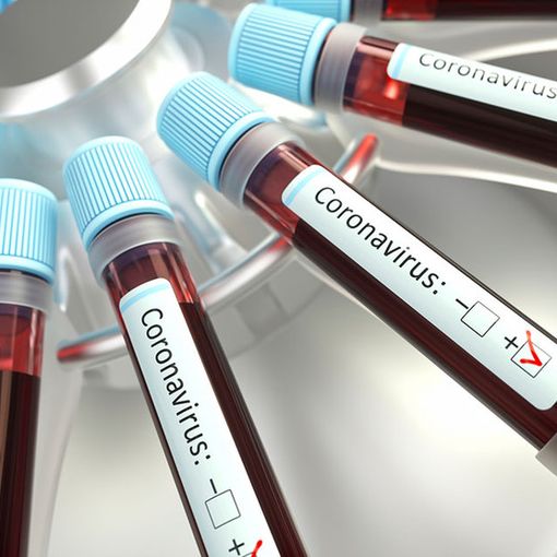 Covid-19, in Italia oggi 10.630 contagi e 422 vittime. In Lombardia 1.625 nuovi positivi