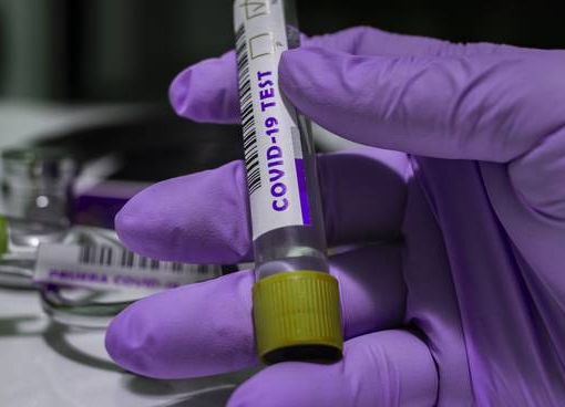 Covid-19, in Italia oggi contagi dimezzati, ma anche tamponi: 10.407 nuovi positivi e 261 vittime