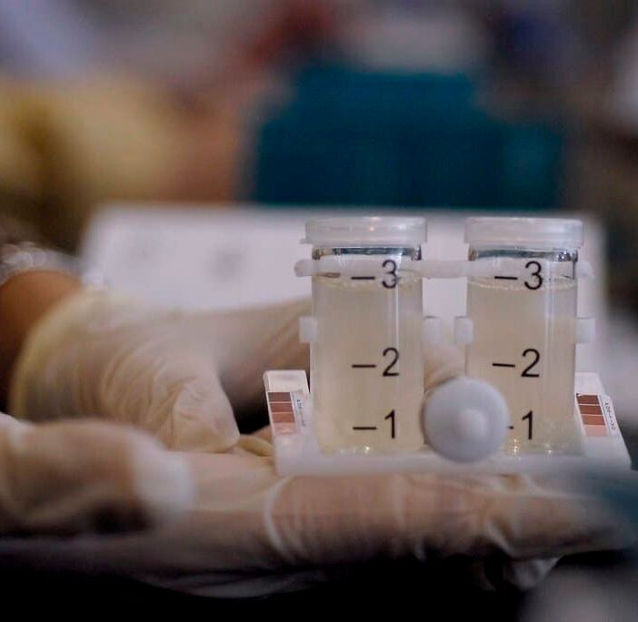Corsico-Buccinasco, dieci casi di legionella. Chiuse le fontane pubbliche