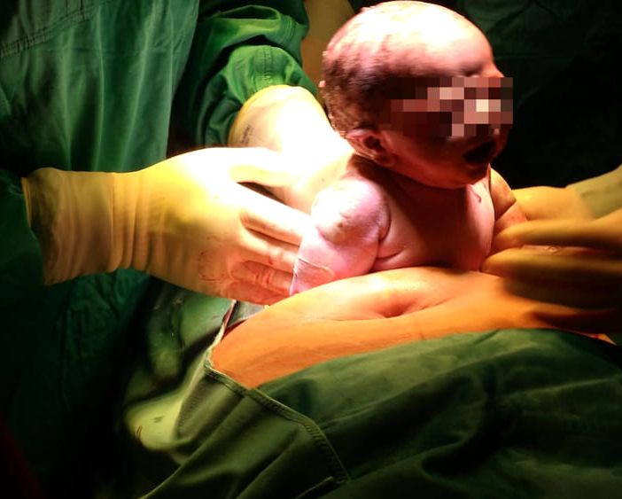 Papà accanto alla mamma anche durante i cesarei: nascita più &quot;dolce&quot; e inclusiva al Policlinico di Milano
